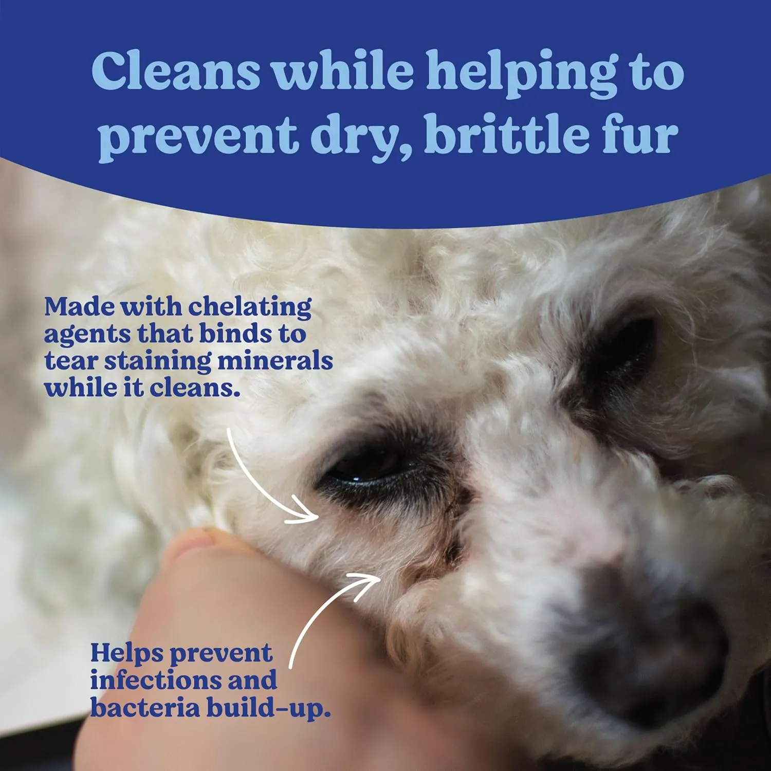 ANGELS' EYES Gentle Tear Stain & Pet Eye Wipes for All Dogs & Cats Textured Grooming Wipes Remove Discharge & Mucus, Reduce Tear Stains, Hypoallergenic with Aloe & Chamomile, 100ct